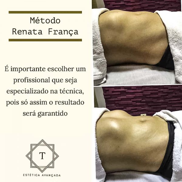 Método Renata França profissional especializada